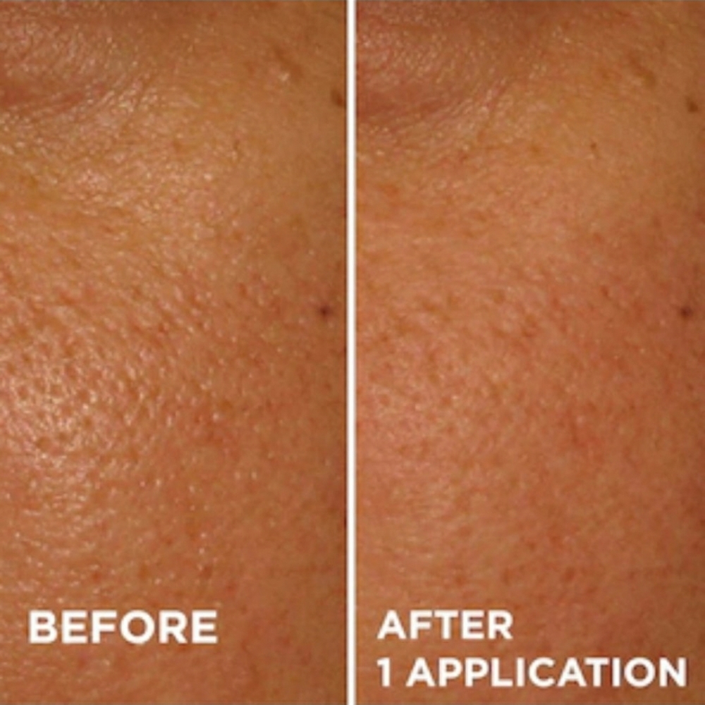 Dr. Brandt PoreDermabrasion - Picture 2 of 3